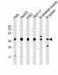 PCBP1 Antibody (Center)
